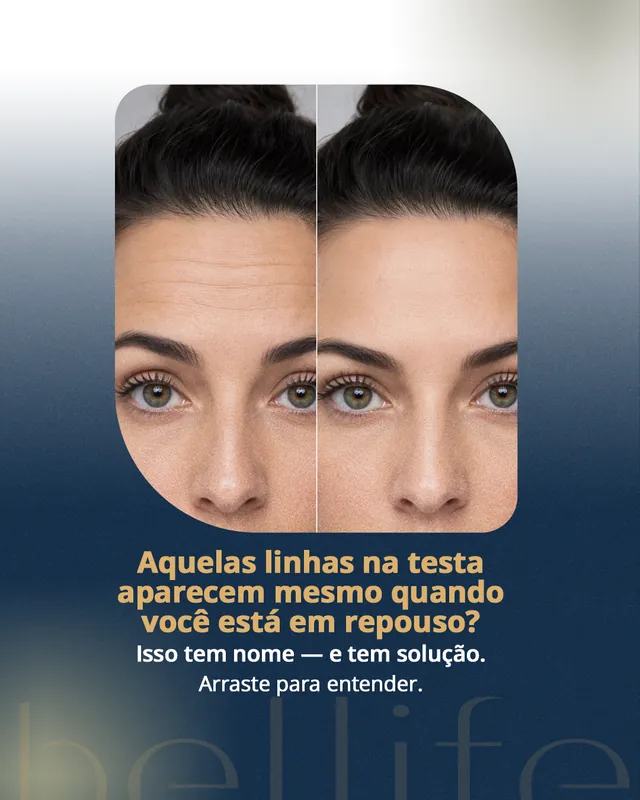 Arte para redes sociais da Bellife Macapá: Aquelas linhas na testa