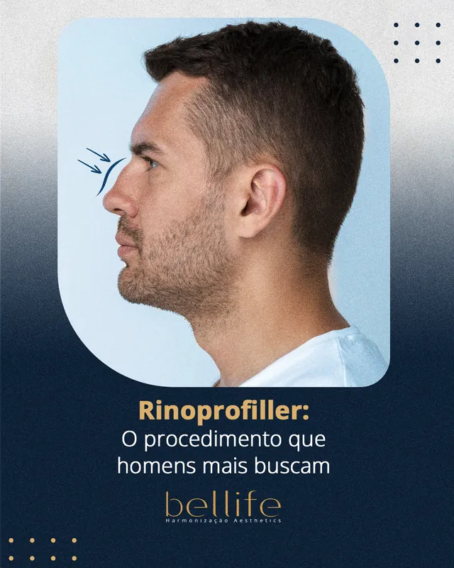 Arte para redes sociais da Bellife Macapá: Rinoprofiller: o procedimento que os homens mais buscam