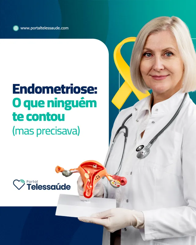Arte para redes sociais da Portal Telessaúde: Endometriose: o que ninguém te contou